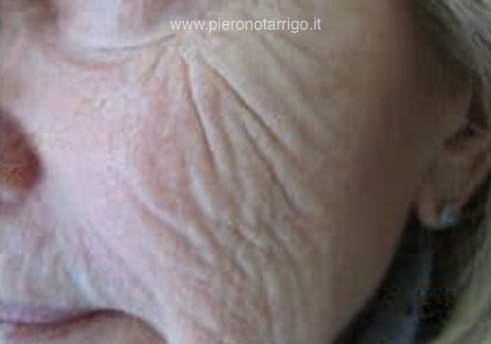 Prima del trattamento